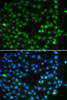 Immunofluorescence analysis of A549 cells using SALL4 antibody (22-720) . Blue: DAPI for nuclear staining.