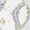 Immunohistochemistry of paraffin-embedded human prostate using WDR77 antibody (22-729) at dilution of 1:200 (40x lens) .