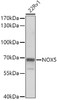 Western blot analysis of extracts of 22Rv1 cells, using NOX5 antibody (22-731) at 1:1000 dilution.<br/>Secondary antibody: HRP Goat Anti-Rabbit IgG (H+L) at 1:10000 dilution.<br/>Lysates/proteins: 25ug per lane.<br/>Blocking buffer: 3% nonfat dry milk in TBST.<br/>Detection: ECL Basic Kit.<br/>Exposure time: 30s.
