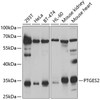 Western blot analysis of extracts of various cell lines, using PTGES2 antibody (22-732) at 1:1000 dilution.<br/>Secondary antibody: HRP Goat Anti-Rabbit IgG (H+L) at 1:10000 dilution.<br/>Lysates/proteins: 25ug per lane.<br/>Blocking buffer: 3% nonfat dry milk in TBST.<br/>Detection: ECL Basic Kit.<br/>Exposure time: 5s.