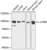 Western blot analysis of extracts of various cell lines, using ATRIP antibody (22-734) at 1:1000 dilution.<br/>Secondary antibody: HRP Goat Anti-Rabbit IgG (H+L) at 1:10000 dilution.<br/>Lysates/proteins: 25ug per lane.<br/>Blocking buffer: 3% nonfat dry milk in TBST.<br/>Detection: ECL Basic Kit.<br/>Exposure time: 1s.
