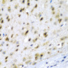 Immunohistochemistry of paraffin-embedded mouse brain using TPH2 antibody (22-739) at dilution of 1:200 (40x lens) .