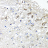 Immunohistochemistry of paraffin-embedded rat brain using METTL20 antibody (22-743) at dilution of 1:100 (40x lens) .