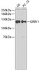 Western blot analysis of extracts of various cell lines, using GRIN1 antibody (22-753) .<br/>Secondary antibody: HRP Goat Anti-Rabbit IgG (H+L) at 1:10000 dilution.<br/>Lysates/proteins: 25ug per lane.<br/>Blocking buffer: 3% nonfat dry milk in TBST.