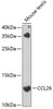 Western blot analysis of extracts of mouse testis, using CCL26 antibody (22-757) at 1:1000 dilution._Secondary antibody: HRP Goat Anti-Rabbit IgG (H+L) at 1:10000 dilution._Lysates/proteins: 25ug per lane._Blocking buffer: 3% nonfat dry milk in TBST._Detection: ECL Enhanced Kit._Exposure time: 90s.