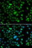 Immunofluorescence analysis of A549 cells using ELF5 antibody (22-761) . Blue: DAPI for nuclear staining.