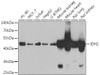 Western blot analysis of extracts of various cell lines, using IDH2 antibody (22-769) at 1:1000 dilution.<br/>Secondary antibody: HRP Goat Anti-Rabbit IgG (H+L) at 1:10000 dilution.<br/>Lysates/proteins: 25ug per lane.<br/>Blocking buffer: 3% nonfat dry milk in TBST.<br/>Detection: ECL Basic Kit.<br/>Exposure time: 90s.