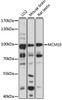 Western blot analysis of extracts of various cell lines, using MCM10 antibody (22-776) at 1:1000 dilution.<br/>Secondary antibody: HRP Goat Anti-Rabbit IgG (H+L) at 1:10000 dilution.<br/>Lysates/proteins: 25ug per lane.<br/>Blocking buffer: 3% nonfat dry milk in TBST.<br/>Detection: ECL Basic Kit.<br/>Exposure time: 60s.