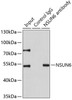 Immunoprecipitation analysis of 200ug extracts of HeLa cells using 1ug NSUN6 antibody (22-782) . Western blot was performed from the immunoprecipitate using NSUN6 antibody (22-782) at a dilition of 1:1000.