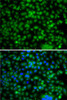 Immunofluorescence analysis of A-549 cells using PHYHD1 antibody (22-785) . Blue: DAPI for nuclear staining.