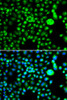 Immunofluorescence analysis of MCF-7 cells using SMCHD1 antibody (22-790) . Blue: DAPI for nuclear staining.