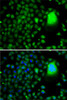 Immunofluorescence analysis of A-549 cells using TAF5 antibody (22-793) . Blue: DAPI for nuclear staining.