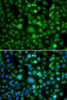 Immunofluorescence analysis of MCF-7 cells using TEK antibody (22-794) . Blue: DAPI for nuclear staining.