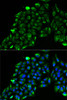 Immunofluorescence analysis of MCF7 cells using ACADS antibody (22-798) . Blue: DAPI for nuclear staining.