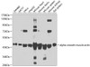 Western blot analysis of extracts of various cell lines, using alpha smooth muscle actin antibody (22-810) at 1:1000 dilution.<br/>Secondary antibody: HRP Goat Anti-Rabbit IgG (H+L) at 1:10000 dilution.<br/>Lysates/proteins: 25ug per lane.<br/>Blocking buffer: 3% nonfat dry milk in TBST.<br/>Detection: ECL Basic Kit.<br/>Exposure time: 90s.