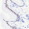 Immunohistochemistry of paraffin-embedded human stomach using Acetyl-Histone H3-K14 antibody (22-813) at dilution of 1:100 (40x lens) .