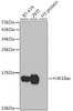 Western blot analysis of extracts of various cell lines, using Acetyl-Histone H3-K18 antibody (22-816) at 1:1000 dilution.<br/>Secondary antibody: HRP Goat Anti-Rabbit IgG (H+L) at 1:10000 dilution.<br/>Lysates/proteins: 25ug per lane.<br/>Blocking buffer: 3% nonfat dry milk in TBST.<br/>Detection: ECL Basic Kit.<br/>Exposure time: 90s.