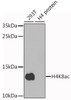 Western blot analysis of extracts of various cell lines, using Acetyl-Histone H4-K8 antibody (22-817) at 1:1000 dilution.<br/>Secondary antibody: HRP Goat Anti-Rabbit IgG (H+L) at 1:10000 dilution.<br/>Lysates/proteins: 25ug per lane.<br/>Blocking buffer: 3% nonfat dry milk in TBST.<br/>Detection: ECL Enhanced Kit.<br/>Exposure time: 90s.