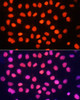Immunofluorescence analysis of HeLa cells using TriMethyl-Histone H3-K64 antibody (22-818) at dilution of 1:100. Blue: DAPI for nuclear staining.