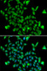 Immunofluorescence analysis of MCF-7 cells using ASPA antibody (22-825) . Blue: DAPI for nuclear staining.