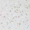 Immunohistochemistry of paraffin-embedded rat brain using PHF19 antibody (22-834) at dilution of 1:100 (40x lens) .