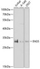 Western blot analysis of extracts of various cell lines, using ING5 antibody (22-837) at 1:1000 dilution._Secondary antibody: HRP Goat Anti-Rabbit IgG (H+L) at 1:10000 dilution._Lysates/proteins: 25ug per lane._Blocking buffer: 3% nonfat dry milk in TBST._Detection: ECL Enhanced Kit._Exposure time: 90s.