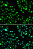 Immunofluorescence analysis of MCF-7 cells using L3MBTL3 antibody (22-838) . Blue: DAPI for nuclear staining.