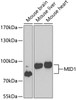 Western blot analysis of extracts of various cell lines, using MID1 antibody (22-839) at 1:1000 dilution._Secondary antibody: HRP Goat Anti-Rabbit IgG (H+L) at 1:10000 dilution._Lysates/proteins: 25ug per lane._Blocking buffer: 3% nonfat dry milk in TBST._Detection: ECL Enhanced Kit._Exposure time: 90s.