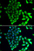 Immunofluorescence analysis of MCF-7 cells using MID1 antibody (22-839) . Blue: DAPI for nuclear staining.