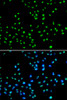Immunofluorescence analysis of MCF-7 cells using NAT10 antibody (22-840) . Blue: DAPI for nuclear staining.