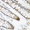 Immunohistochemistry of paraffin-embedded human colon using NCBP2 antibody (22-841) at dilution of 1:200 (40x lens) .