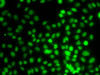 Immunofluorescence analysis of MCF-7 cells using SETD8 antibody (22-850) .