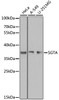 Western blot analysis of extracts of various cell lines, using SGTA antibody (22-851) at 1:1000 dilution.<br/>Secondary antibody: HRP Goat Anti-Rabbit IgG (H+L) at 1:10000 dilution.<br/>Lysates/proteins: 25ug per lane.<br/>Blocking buffer: 3% nonfat dry milk in TBST.<br/>Detection: ECL Basic Kit.<br/>Exposure time: 90s.