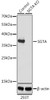 Western blot analysis of extracts from normal (control) and SGTA knockout (KO) 293T cells, using SGTA antibody (22-851) at 1:1000 dilution.<br/>Secondary antibody: HRP Goat Anti-Rabbit IgG (H+L) at 1:10000 dilution.<br/>Lysates/proteins: 25ug per lane.<br/>Blocking buffer: 3% nonfat dry milk in TBST.<br/>Detection: ECL Basic Kit.<br/>Exposure time: 30s.