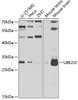 Western blot analysis of extracts of various cell lines, using UBE2J2 antibody (22-858) at 1:1000 dilution._Secondary antibody: HRP Goat Anti-Rabbit IgG (H+L) at 1:10000 dilution._Lysates/proteins: 25ug per lane._Blocking buffer: 3% nonfat dry milk in TBST._Detection: ECL Enhanced Kit._Exposure time: 90s.