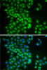 Immunofluorescence analysis of A-549 cells using YTHDC1 antibody (22-860) . Blue: DAPI for nuclear staining.