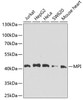 Western blot analysis of extracts of various cell lines, using MPI antibody (22-861) at 1:1000 dilution.<br/>Secondary antibody: HRP Goat Anti-Rabbit IgG (H+L) at 1:10000 dilution.<br/>Lysates/proteins: 25ug per lane.<br/>Blocking buffer: 3% nonfat dry milk in TBST.<br/>Detection: ECL Basic Kit.<br/>Exposure time: 30s.