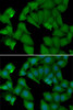 Immunofluorescence analysis of MCF7 cells using HBA1 antibody (22-863) . Blue: DAPI for nuclear staining.