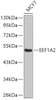 Western blot analysis of extracts of MCF-7 cells, using EEF1A2 antibody (22-866) .<br/>Secondary antibody: HRP Goat Anti-Rabbit IgG (H+L) at 1:10000 dilution.<br/>Lysates/proteins: 25ug per lane.<br/>Blocking buffer: 3% nonfat dry milk in TBST.