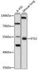 Western blot analysis of extracts of various cell lines, using SPRY3 antibody (22-867) at 1:1000 dilution.<br/>Secondary antibody: HRP Goat Anti-Rabbit IgG (H+L) at 1:10000 dilution.<br/>Lysates/proteins: 25ug per lane.<br/>Blocking buffer: 3% nonfat dry milk in TBST.<br/>Detection: ECL Basic Kit.<br/>Exposure time: 10s.
