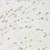 Immunohistochemistry of paraffin-embedded rat brain using KU70 antibody (22-868) at dilution of 1:100 (40x lens) .