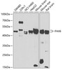 Western blot analysis of extracts of various cell lines, using PAX6 antibody (22-869) at 1:1000 dilution.<br/>Secondary antibody: HRP Goat Anti-Rabbit IgG (H+L) at 1:10000 dilution.<br/>Lysates/proteins: 25ug per lane.<br/>Blocking buffer: 3% nonfat dry milk in TBST.<br/>Detection: ECL Enhanced Kit.<br/>Exposure time: 30s.