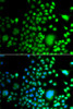 Immunofluorescence analysis of A549 cells using PAX6 antibody (22-869) . Blue: DAPI for nuclear staining.