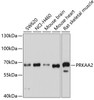 Western blot analysis of extracts of various cell lines, using PRKAA2 antibody (22-874) at 1:1000 dilution.<br/>Secondary antibody: HRP Goat Anti-Rabbit IgG (H+L) at 1:10000 dilution.<br/>Lysates/proteins: 25ug per lane.<br/>Blocking buffer: 3% nonfat dry milk in TBST.<br/>Detection: ECL Basic Kit.<br/>Exposure time: 20s.