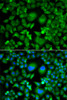 Immunofluorescence analysis of A549 cells using UBE2H antibody (22-879) . Blue: DAPI for nuclear staining.