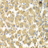 Immunohistochemistry of paraffin-embedded human liver damage using MAP4K3 antibody (22-884) at dilution of 1:100 (40x lens) .