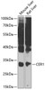 Western blot analysis of extracts of various cell lines, using CER1 Antibody (22-887) at 1:1000 dilution.<br/>Secondary antibody: HRP Goat Anti-Rabbit IgG (H+L) at 1:10000 dilution.<br/>Lysates/proteins: 25ug per lane.<br/>Blocking buffer: 3% nonfat dry milk in TBST.<br/>Detection: ECL Basic Kit.<br/>Exposure time: 90s.