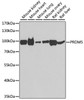 Western blot analysis of extracts of various cell lines, using PRDM5 antibody (22-890) at 1:1000 dilution.<br/>Secondary antibody: HRP Goat Anti-Rabbit IgG (H+L) at 1:10000 dilution.<br/>Lysates/proteins: 25ug per lane.<br/>Blocking buffer: 3% nonfat dry milk in TBST.<br/>Detection: ECL Basic Kit.<br/>Exposure time: 90s.