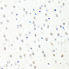 Immunohistochemistry of paraffin-embedded mouse brain using CHRAC1 antibody (22-896) at dilution of 1:100 (40x lens) .