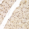 Immunohistochemistry of paraffin-embedded human colon using SUPT20H antibody (22-898) at dilution of 1:100 (40x lens) .